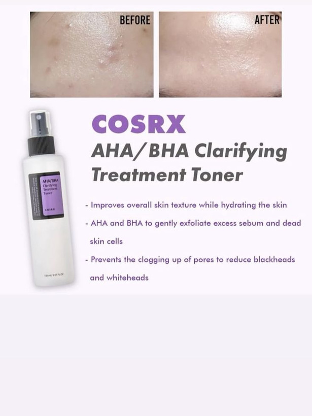 تونر درمانی لایه بردار و آبرسان و درمان جوش کلریفایینگ aha/bha کوزارکس اصل کره