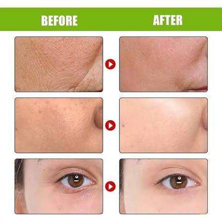کرم ضد چروک و کوچک کننده منافذ رتینول شات سلیمکس اصل
