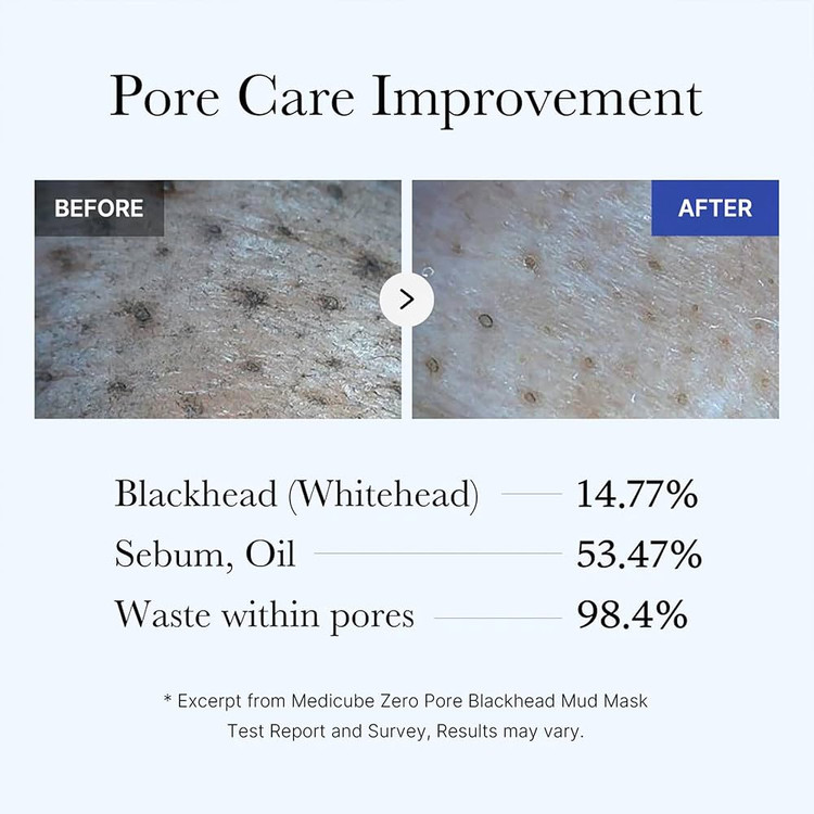 ماسک پاکسازی منافذ مدیکیوب اصل کره | لوکس بیوتی | Zero Pore , Blackhead Mud Mask