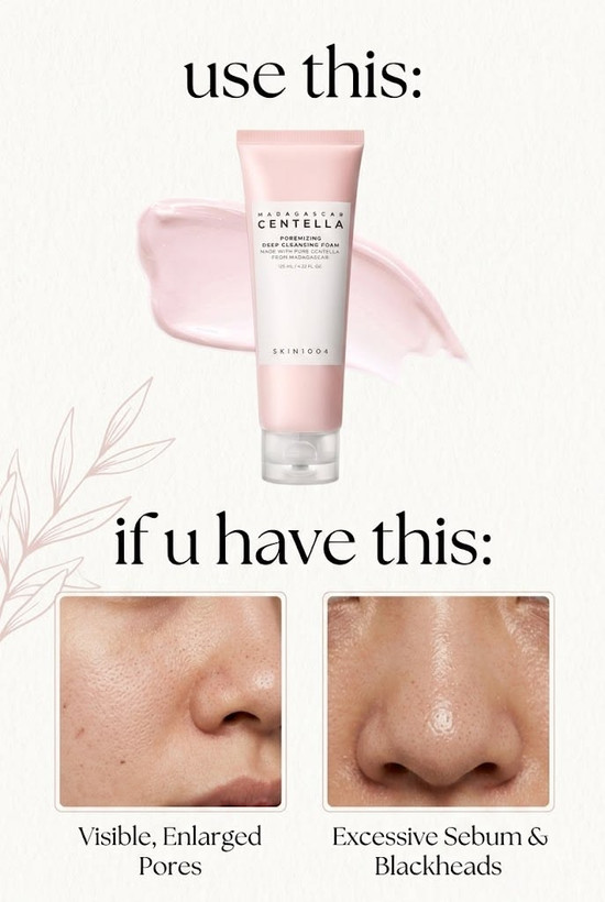 خرید و بررسی فوم شوینده منافذ سنتلا SKIN1004 Poremizing 125ml | لوکس بیوتی