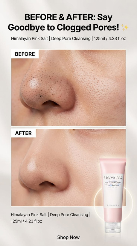 خرید و بررسی فوم شوینده منافذ سنتلا SKIN1004 Poremizing 125ml | لوکس بیوتی